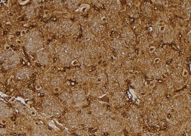 NUTF2 / PP15 Antibody - 1:100 staining rat brain tissue by IHC-P. The sample was formaldehyde fixed and a heat mediated antigen retrieval step in citrate buffer was performed. The sample was then blocked and incubated with the antibody for 1.5 hours at 22°C. An HRP conjugated goat anti-rabbit antibody was used as the secondary.