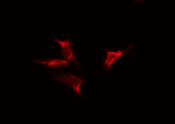 NUTF2 / PP15 Antibody - Staining HeLa cells by IF/ICC. The samples were fixed with PFA and permeabilized in 0.1% Triton X-100, then blocked in 10% serum for 45 min at 25°C. The primary antibody was diluted at 1:200 and incubated with the sample for 1 hour at 37°C. An Alexa Fluor 594 conjugated goat anti-rabbit IgG (H+L) antibody, diluted at 1/600, was used as secondary antibody.