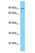 NUTM2A Antibody - NUTM2A antibody Western Blot of HT1080. Antibody dilution: 1 ug/ml.  This image was taken for the unconjugated form of this product. Other forms have not been tested.
