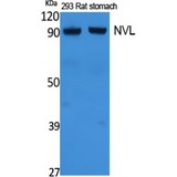NVL Antibody - Western blot of NVL antibody
