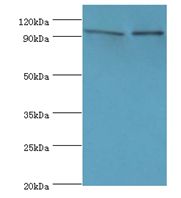NVL Antibody - Western blot. All lanes: NVL antibody at 10 ug/ml. Lane 1: mouse thymus tissue. Lane 2: HeLa whole cell lysate. Secondary antibody: Goat polyclonal to rabbit at 1:10000 dilution. Predicted band size: 95 kDa. Observed band size: 95 kDa.