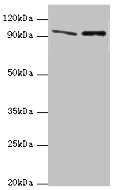 NVL Antibody - Western blot All lanes: NVL antibody at 10µg/ml Lane 1: Mouse thymus tissue Lane 2: Hela whole cell lysate Secondary Goat polyclonal to rabbit IgG at 1/10000 dilution Predicted band size: 96, 83, 73, 74, 86 kDa Observed band size: 96 kDa