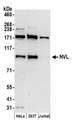 NVL Antibody - Detection of human NVL by western blot. Samples: Whole cell lysate (50 µg) from HeLa, HEK293T, and Jurkat cells prepared using NETN lysis buffer. Antibody: Affinity purified rabbit anti-NVL antibody used for WB at 0.1 µg/ml. Detection: Chemiluminescence with an exposure time of 3 minutes.