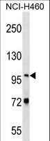 NVL Antibody - NVL Antibody western blot of NCI-H460 cell line lysates (35 ug/lane). The NVL antibody detected the NVL protein (arrow).