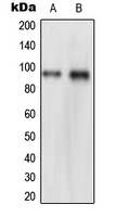NVL Antibody - Western blot analysis of NVL expression in HeLa (A); THP1 (B) whole cell lysates.