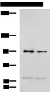 NVL Antibody - Western blot analysis of 293T and Jurkat cell lysates  using NVL Polyclonal Antibody at dilution of 1:1000