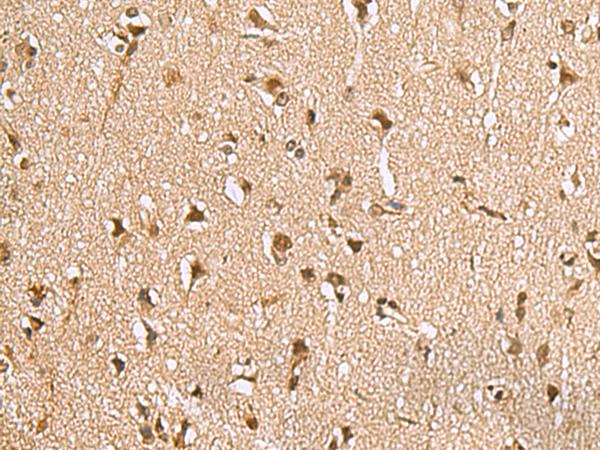 NVL Antibody - Immunohistochemistry of paraffin-embedded Human brain tissue  using NVL Polyclonal Antibody at dilution of 1:70(×200)
