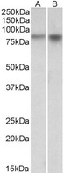 NXF / NPAS4 Antibody - Goat Anti-NPAS4 Antibody (1µg/ml) staining of Mouse (A) and Rat (B) Brain lysates (35µg protein in RIPA buffer). Primary incubation was 1 hour. Detected by chemiluminescencence.