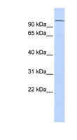 NXF / NPAS4 Antibody - NPAS4 antibody Western blot of Fetal Lung lysate. This image was taken for the unconjugated form of this product. Other forms have not been tested.