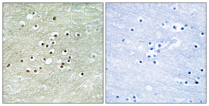 NXF / NPAS4 Antibody - Immunohistochemistry analysis of paraffin-embedded human brain tissue, using NPAS4 Antibody. The picture on the right is blocked with the synthesized peptide.