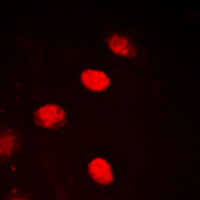 NXF / NPAS4 Antibody - Immunofluorescent analysis of NPAS4 staining in HEK293T cells. Formalin-fixed cells were permeabilized with 0.1% Triton X-100 in TBS for 5-10 minutes and blocked with 3% BSA-PBS for 30 minutes at room temperature. Cells were probed with the primary antibody in 3% BSA-PBS and incubated overnight at 4 deg C in a humidified chamber. Cells were washed with PBST and incubated with a DyLight 594-conjugated secondary antibody (red) in PBS at room temperature in the dark. DAPI was used to stain the cell nuclei (blue).