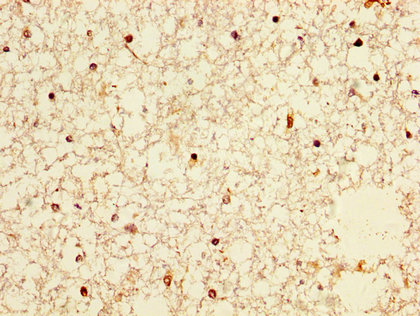 NXF / NPAS4 Antibody - Immunohistochemistry image at a dilution of 1:300 and staining in paraffin-embedded human brain tissue performed on a Leica BondTM system. After dewaxing and hydration, antigen retrieval was mediated by high pressure in a citrate buffer (pH 6.0) . Section was blocked with 10% normal goat serum 30min at RT. Then primary antibody (1% BSA) was incubated at 4 °C overnight. The primary is detected by a biotinylated secondary antibody and visualized using an HRP conjugated SP system.