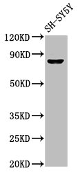 NXF / NPAS4 Antibody - Positive Western Blot detected in SH-SY5Y whole cell lysate. All lanes: NPAS4 antibody at 7 µg/ml Secondary Goat polyclonal to rabbit IgG at 1/50000 dilution. Predicted band size: 88, 26 KDa. Observed band size: 88 KDa