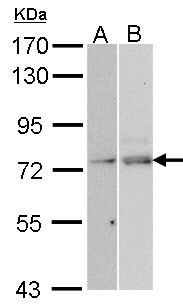 NXF1 / TAP Antibody - Sample (30 ug of whole cell lysate). A: Hela, B: Molt-4 . 7.5% SDS PAGE. NXF1 / TAP antibody diluted at 1:1000.
