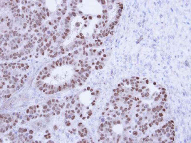 NXF1 / TAP Antibody - IHC of paraffin-embedded NCIN87 Xenograft using TAP antibody at 1:100 dilution.