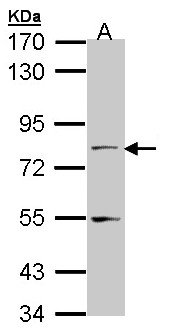 NXF1 / TAP Antibody - Sample (30 ug of whole cell lysate). A: A431 . 7.5% SDS PAGE. NXF1 / TAP antibody diluted at 1:1000.