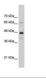 NXF1 / TAP Antibody - HepG2 Cell Lysate.  This image was taken for the unconjugated form of this product. Other forms have not been tested.