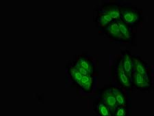 NXF1 / TAP Antibody - Immunofluorescent analysis of HepG2 cells diluted at 1:100 and Alexa Fluor 488-congugated AffiniPure Goat Anti-Rabbit IgG(H+L)