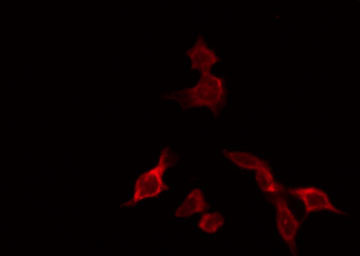 NXF1 / TAP Antibody - Staining HeLa cells by IF/ICC. The samples were fixed with PFA and permeabilized in 0.1% Triton X-100, then blocked in 10% serum for 45 min at 25°C. The primary antibody was diluted at 1:200 and incubated with the sample for 1 hour at 37°C. An Alexa Fluor 594 conjugated goat anti-rabbit IgG (H+L) Ab, diluted at 1/600, was used as the secondary antibody.