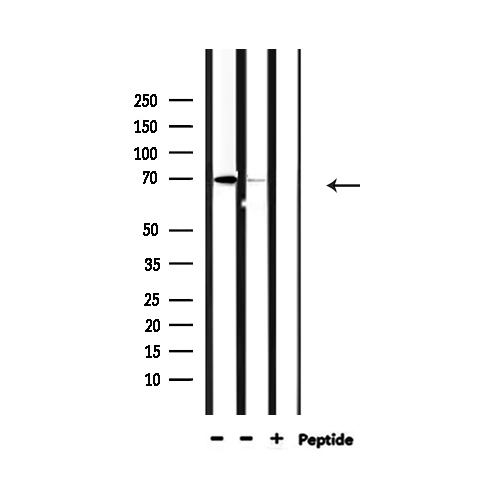 NXF1 / TAP Antibody - Western blot analysis of extracts of 293 cells and HeLa cells using NXF1 antibody.