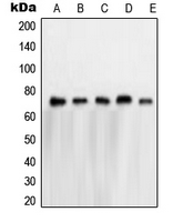NXF1 / TAP Antibody - Western blot analysis of NXF1 expression in HeLa (A); A673 (B); K562 (C); Jurkat (D); A431 (E) whole cell lysates.