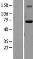 NXF1 / TAP Protein - Western validation with an anti-DDK antibody * L: Control HEK293 lysate R: Over-expression lysate