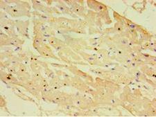 NXF3 Antibody - Immunohistochemistry of paraffin-embedded human heart tissue using antibody at 1:100 dilution.  This image was taken for the unconjugated form of this product. Other forms have not been tested.