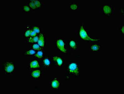 NXF3 Antibody - Immunofluorescent analysis of MCF-7 cells using NXF3 Antibody at dilution of 1:100 and Alexa Fluor 488-congugated AffiniPure Goat Anti-Rabbit IgG(H+L)