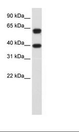 NXF3 Antibody - RPM18226 Cell Lysate.  This image was taken for the unconjugated form of this product. Other forms have not been tested.
