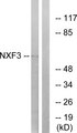 NXF3 Antibody - Western blot analysis of lysates from MCF-7 cells, using NXF3 Antibody. The lane on the right is blocked with the synthesized peptide.