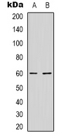 NXF3 Antibody - Western blot analysis of NXF3 expression in HepG2 (A); MCF7 (B) whole cell lysates.