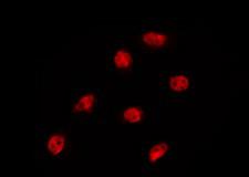 NXF3 Antibody - Staining MCF-7 cells by IF/ICC. The samples were fixed with PFA and permeabilized in 0.1% Triton X-100, then blocked in 10% serum for 45 min at 25°C. The primary antibody was diluted at 1:200 and incubated with the sample for 1 hour at 37°C. An Alexa Fluor 594 conjugated goat anti-rabbit IgG (H+L) Ab, diluted at 1/600, was used as the secondary antibody.