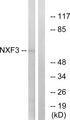 NXF3 Antibody - Western blot analysis of extracts from MCF-7 cells, using NXF3 antibody.