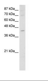 NXF5 Antibody - Jurkat Cell Lysate.  This image was taken for the unconjugated form of this product. Other forms have not been tested.