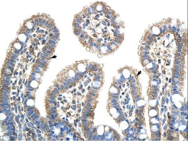 NXF5 Antibody - NXF5 antibody ARP41062_T100-NP_116564-NXF5 (nuclear RNA export factor 5) Antibody was used in IHC to stain formalin-fixed, paraffin-embedded human intestine.  This image was taken for the unconjugated form of this product. Other forms have not been tested.