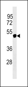 NXF5 Antibody - NXF5 Antibody western blot of Jurkat cell line lysates (35 ug/lane). The NXF5 Antibody detected the NXF5 protein (arrow).
