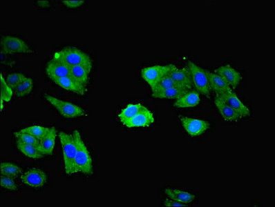 NXF5 Antibody - Immunofluorescent analysis of HepG2 cells using NXF5 Antibody at dilution of 1:100 and Alexa Fluor 488-congugated AffiniPure Goat Anti-Rabbit IgG(H+L)
