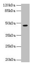 NXF5 Antibody - Western blot All lanes: NXF5 antibody at 4µg/ml + HL60 whole cell lysate Secondary Goat polyclonal to rabbit IgG at 1/10000 dilution Predicted band size: 46, 43, 20, 36, 35 kDa Observed band size: 46 kDa