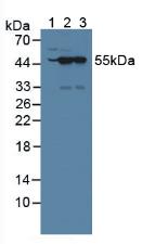 NXN Antibody - Western Blot; Sample: Lane1: Mouse Brain Tissue; Lane2: Mouse Testis Tissue; Lane3: Rat Testis Tissue.