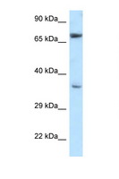 NXN Antibody - NXN antibody Western blot of H226 Cell lysate. Antibody concentration 1 ug/ml.  This image was taken for the unconjugated form of this product. Other forms have not been tested.