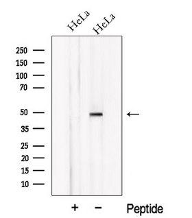 NXN Antibody - Western blot analysis of extracts of HeLa cells using NXN antibody. The lane on the left was treated with blocking peptide.
