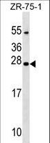 NXNL1 / TXNL6 Antibody - NXNL1 Antibody western blot of ZR-75-1 cell line lysates (35 ug/lane). The NXNL1 antibody detected the NXNL1 protein (arrow).