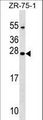 NXNL1 / TXNL6 Antibody - NXNL1 Antibody western blot of ZR-75-1 cell line lysates (35 ug/lane). The NXNL1 antibody detected the NXNL1 protein (arrow).