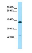 NXNL1 / TXNL6 Antibody - NXNL1 / TXNL6 antibody Western Blot of ACHN.  This image was taken for the unconjugated form of this product. Other forms have not been tested.