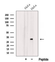 NXNL1 / TXNL6 Antibody - Western blot analysis of extracts of HeLa cells using TXNL6 antibody. The lane on the left was treated with blocking peptide.