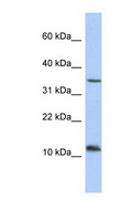 NXNL2 Antibody - NXNL2 antibody Western blot of Jurkat lysate. This image was taken for the unconjugated form of this product. Other forms have not been tested.