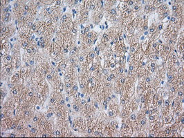 NXNL2 Antibody - Immunohistochemical staining of paraffin-embedded Human liver tissue using anti-NXNL2 mouse monoclonal antibody.