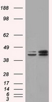 NXNL2 Antibody - HEK293T cells were transfected with the pCMV6-ENTRY control (Left lane) or pCMV6-ENTRY NXNL2 (Right lane) cDNA for 48 hrs and lysed. Equivalent amounts of cell lysates (5 ug per lane) were separated by SDS-PAGE and immunoblotted with anti-NXNL2.