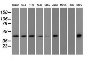 NXNL2 Antibody - Western blot analysis of extracts (35ug) from 9 different cell lines by using anti-NXNL2 monoclonal antibody.