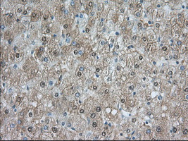 NXNL2 Antibody - Immunohistochemical staining of paraffin-embedded Human liver tissue using anti-NXNL2 mouse monoclonal antibody. (Dilution 1:50).